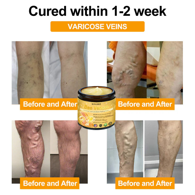 [ ⭐ utánvétel (COD) ⭐ ]RINGMIZ Méhméreg Fejlett Ízületi és Csontgyógyító Krém