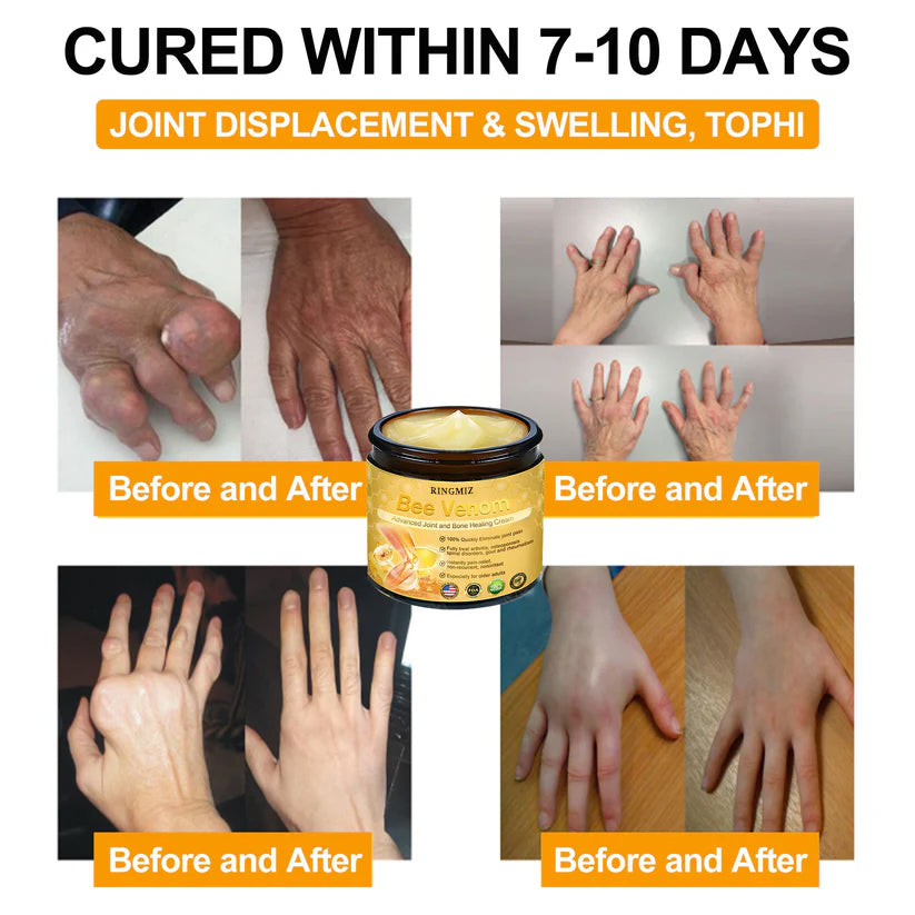 [ ⭐ utánvétel (COD) ⭐ ]RINGMIZ Méhméreg Fejlett Ízületi és Csontgyógyító Krém