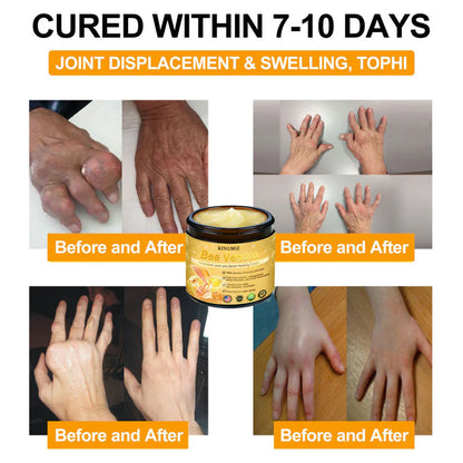 [ ⭐ utánvétel (COD) ⭐ ]RINGMIZ Méhméreg Fejlett Ízületi és Csontgyógyító Krém