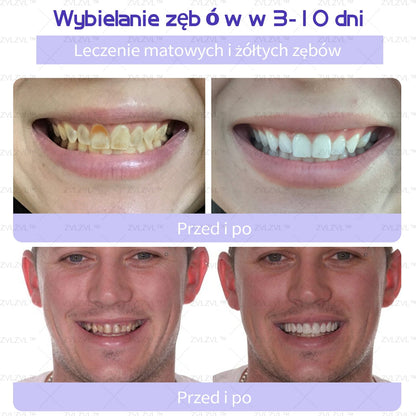 Dr. Max hivatalos zászlóshajó üzlet | ZVLTM ásványi fogjavító por 🦷 (PTS ajánlással) (Korlátozott ideig érvényes ajánlat – Ne hagyja ki)